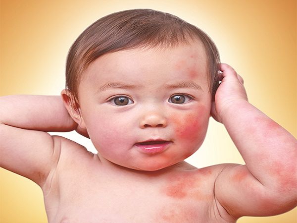Họng bé bị kích ứng có thể khiến trẻ ho khan, đau rát họng, nuốt vướng, khàn tiếng hoặc ngủ không ngon. Tìm hiểu dấu hiệu cha mẹ cần chú ý và cách chăm sóc họng cho trẻ đúng cách.